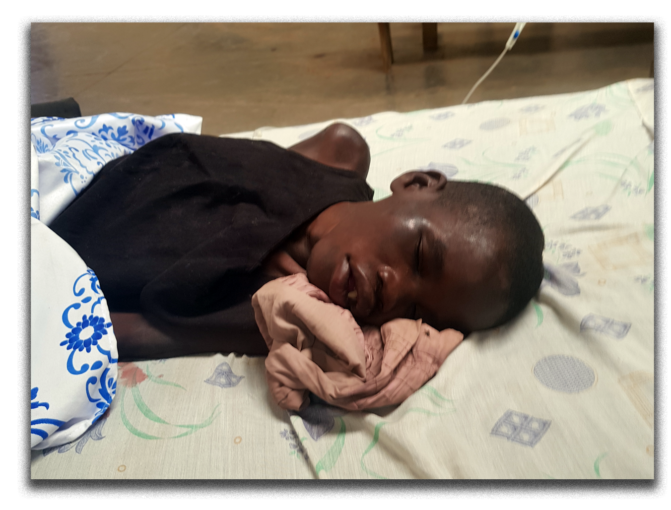 A child resting after treatment, out of danger.